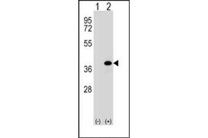 Image no. 2 for anti-Aldo-Keto Reductase Family 1, Member B1 (Aldose Reductase) (AKR1B1) (AA 287-316), (C-Term) antibody (ABIN357880) (AKR1B1 抗体  (C-Term))