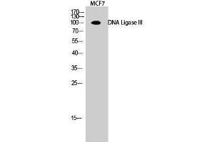 Western Blotting (WB) image for anti-Ligase III, DNA, ATP-Dependent (LIG3) (Internal Region) antibody (ABIN3184322) (LIG3 抗体  (Internal Region))