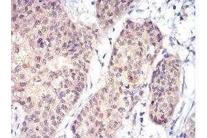 Immunohistochemistry (IHC) image for anti-RAD23 Homolog A (RAD23A) (AA 1-363) antibody (ABIN5542637)