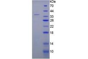 SDS-PAGE analysis of Rat C5a Protein.