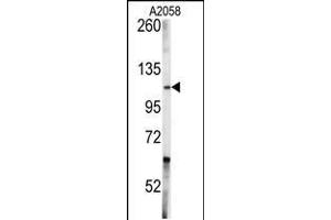 Western blot analysis of anti-ABL1 Antibody in A2058 cell line lysates (35ug/lane) (ABL1 抗体  (AA 741-769))