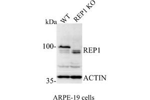 Western Blotting (WB) image for anti-Choroideremia (Rab Escort Protein 1) (CHM) (C-Term) antibody (ABIN6254222) (CHM 抗体  (C-Term))