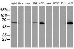 Image no. 3 for anti-Epsin 2 (EPN2) antibody (ABIN1498052) (Epsin 2 抗体)