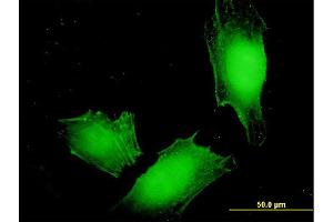Immunofluorescence of monoclonal antibody to MAGEA4 on HeLa cell. (MAGEA4 抗体  (AA 98-171))