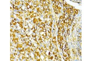 Immunohistochemistry of paraffin-embedded Rat ovary using VAMP1 Polyclonal Antibody at dilution of 1:100 (40x lens). (VAMP1 抗体)