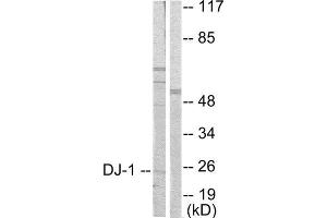 Western Blotting (WB) image for anti-Parkinson Protein 7 (PARK7) (Internal Region) antibody (ABIN1848506) (PARK7/DJ1 抗体  (Internal Region))