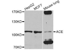 Western blot analysis of extracts of various cell lines, using ACE antibody. (Angiotensin I Converting Enzyme 1 抗体  (AA 30-270))