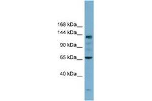 Image no. 1 for anti-Isoleucyl-tRNA Synthetase (IARS) (AA 35-84) antibody (ABIN6741923) (IARS 抗体  (AA 35-84))