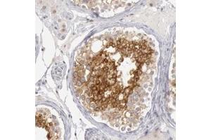 Immunohistochemical staining of human breast with RIMBP3 polyclonal antibody  shows strong cytoplasmic positivity in cells in seminiferus ducts. (RIMBP3 抗体)