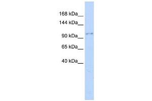 NEDD4 antibody used at 1 ug/ml to detect target protein. (NEDD4 抗体  (Middle Region))