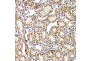 Immunohistochemistry of paraffin-embedded rat kidney using ANAPC5 antibody at dilution of 1:100 (x400 lens). (ANAPC5 抗体)