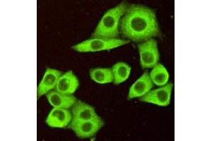 Immunocytochemistry of HeLa cells fixed by Paraformaldehyde and using DR5 mouse mAb diluted 1:100. (TNFRSF10B 抗体)