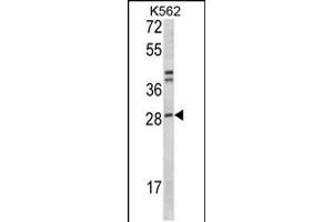 Western blot analysis of ITGB1BP3 Antibody in K562 cell line lysates (35ug/lane) (ITGB1BP3 抗体  (N-Term))