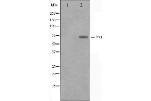 Western blot analysis on Jurkat cell lysate using p73 Antibody. (Tumor Protein p73 抗体  (Internal Region))