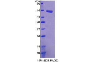 SDS-PAGE analysis of Mouse SDHC Protein. (SDHC 蛋白)