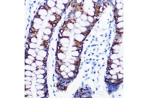 Immunohistochemistry of paraffin-embedded human colon using Monoamine Oxidase A (MAOA) (MAOA) Rabbit mAb (ABIN1682632, ABIN3018542, ABIN3018543 and ABIN7101625) at dilution of 1:100 (40x lens). (Monoamine Oxidase A 抗体)