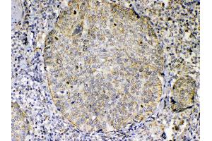 IHC analysis of TNFSF18 using anti-TNFSF18 antibody . (TNFSF18 抗体  (AA 70-199))