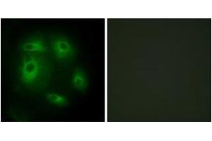 Immunofluorescence analysis of HeLa cells, using DLEC1 Antibody. (DLEC1 抗体  (AA 1-50))