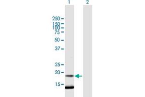 Western Blot analysis of C12orf65 expression in transfected 293T cell line by C12orf65 MaxPab polyclonal antibody. (C12orf65 抗体  (AA 1-166))