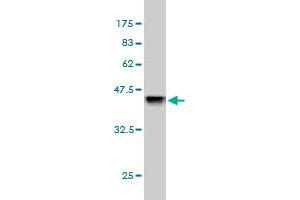 Western Blotting (WB) image for anti-Cystatin B (Stefin B) (CSTB) (AA 1-98) antibody (ABIN560509)