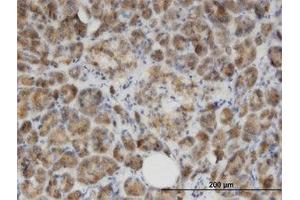 Image no. 1 for anti-Glycine N-Acyltransferase (GLYAT) (AA 64-164) antibody (ABIN599511) (GLYAT 抗体  (AA 64-164))