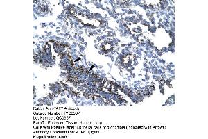 Immunohistochemistry (IHC) image for anti-TAF7 RNA Polymerase II, TATA Box Binding Protein (TBP)-Associated Factor, 55kDa (TAF7) (N-Term) antibody (ABIN2774669)