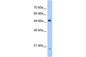Western Blotting (WB) image for anti-Zinc Finger, DHHC-Type Containing 16 (ZDHHC16) (N-Term) antibody (ABIN634917)