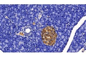 Immunohistochemistry (IHC) image for anti-Somatostatin (SST) (AA 27-116) antibody (ABIN7429973)