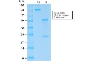 SDS-PAGE Analysis of Purified Kappa Light Chain Rabbit Recombinant Monoclonal (KLC2289R). (Recombinant IGKC 抗体)