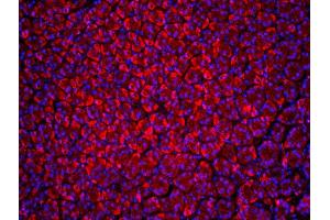 Immunofluorescence (IF) image for anti-Beclin 1, Autophagy Related (BECN1) (AA 201-330) antibody (ABIN675384)