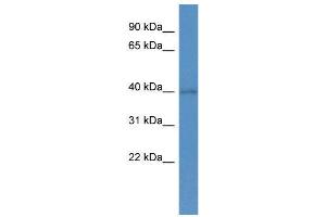 WB Suggested Anti-SOX1 AntibodyTitration: 1. (SOX1 抗体  (N-Term))