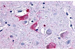 Image no. 1 for anti-Melanin-Concentrating Hormone Receptor 2 (MCHR2) (Cytoplasmic Domain) antibody (ABIN1049055) (MCHR2 抗体  (Cytoplasmic Domain))