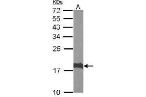 Western Blotting (WB) image for anti-Cofilin 1 (CFL1) antibody (ABIN2855302)