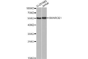 Western blot analysis of extracts of various cell lines, using SMARCE1 antibody.
