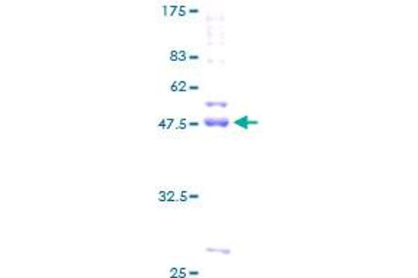 CDIPT Protein (AA 1-213) (GST tag)