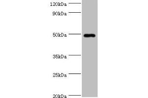 Western blot All lanes: HYAL1 antibody at 2 μg/mL + HepG2 whole cell lysate Secondary Goat polyclonal to rabbit IgG at 1/10000 dilution Predicted band size: 49, 46, 28, 24, 20, 11, 38 kDa Observed band size: 49 kDa (HYAL1 抗体  (AA 136-435))