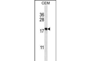 EIF5A2 Antibody (C-term) (ABIN657973 and ABIN2846919) western blot analysis in CEM cell line lysates (35 μg/lane). (EIF5A2 抗体  (C-Term))