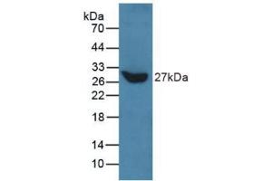 Western blot analysis of recombinant Human TLN. (Talin 抗体  (AA 975-1181))
