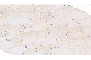 Detection of CASP6 in Bovine Skeletal muscle Tissue using Polyclonal Antibody to Caspase 6 (CASP6) (Caspase 6 抗体  (AA 194-293))