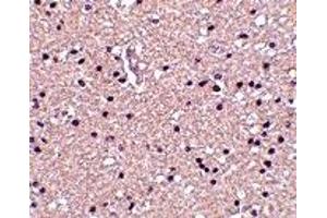 Immunohistochemistry (IHC) image for anti-Stathmin 1 (STMN1) (N-Term) antibody (ABIN1031495) (Stathmin 1 抗体  (N-Term))