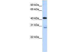 WB Suggested Anti-GRAMD2 Antibody Titration:  0. (GRAMD2 抗体  (Middle Region))