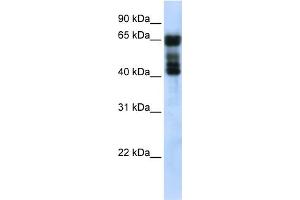 WB Suggested Anti-UGT2B4 Antibody Titration:  0. (UGT2B4 抗体  (N-Term))