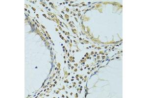 Immunohistochemistry of paraffin-embedded human colon using METTL13 antibody. (METTL13 抗体)