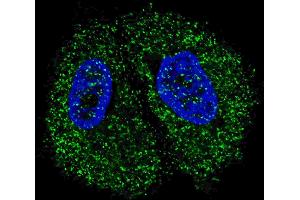 Immunofluorescence (IF) image for anti-Pyruvate Kinase M2 (PKM2) (AA 476-505), (C-Term) antibody (ABIN391053)
