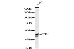Western blot analysis of extracts of Rat liver, using CYP2E1 Rabbit pAb antibody (ABIN3023078, ABIN3023079, ABIN3023080 and ABIN6219379) at 1:1000 dilution. (CYP2E1 抗体  (AA 234-493))