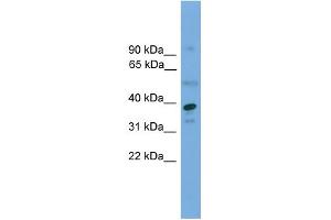 WB Suggested Anti-APEX1 Antibody Titration: 0. (APEX1 抗体  (Middle Region))