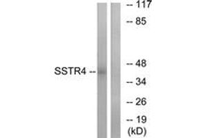 Western blot analysis of extracts from LOVO cells, using SSTR4 Antibody. (SSTR4 抗体  (AA 155-204))