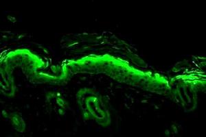 Nitrotyrosine (39B6), mouse backskin (Nitrotyrosine 抗体)