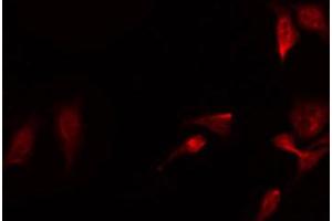 ABIN6267640 staining Hela by IF/ICC. (eIF4EBP1 抗体  (pThr36))