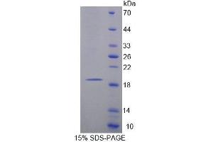 SDS-PAGE analysis of Rat MARCO Protein. (MARCO 蛋白)